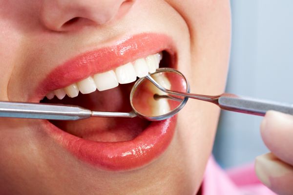 dental_checkups_in_irving_tx