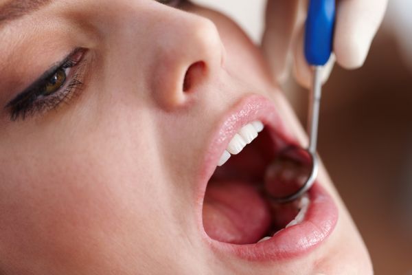 Oral_cancer